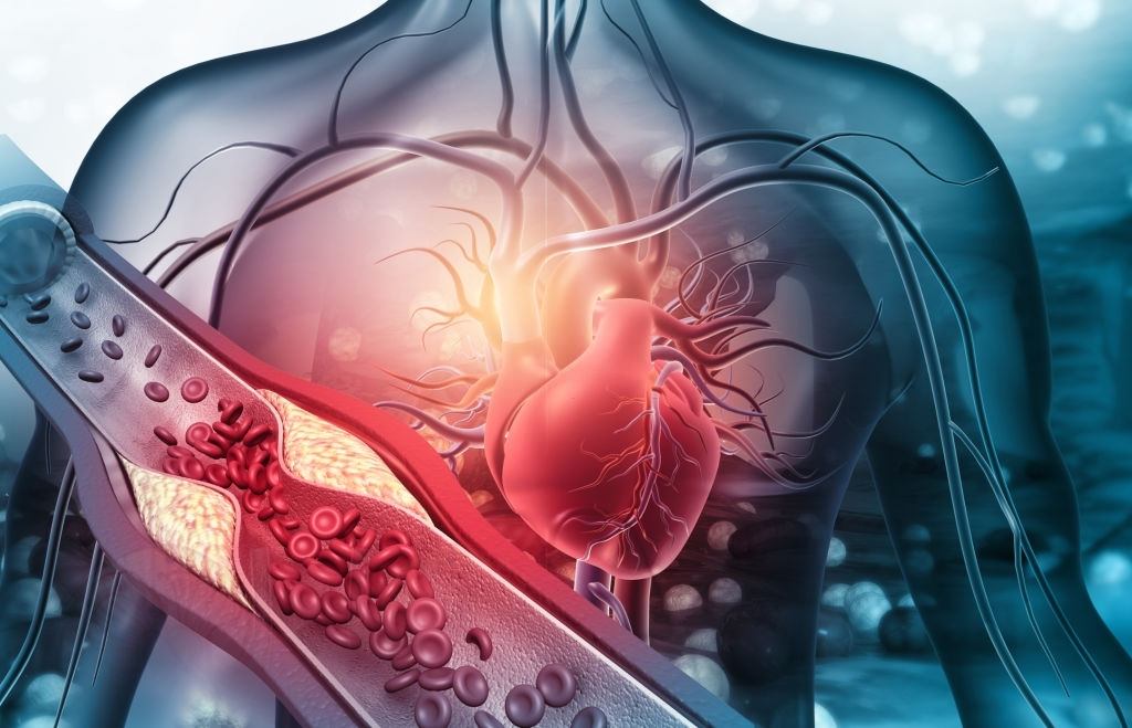 kalp krizinin sağlığa etkileri